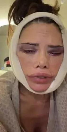 Yüz nakli olan Survivor Didem Ceran, bir kez daha bıçak altına yattı Gözyaşlarını tutamadı