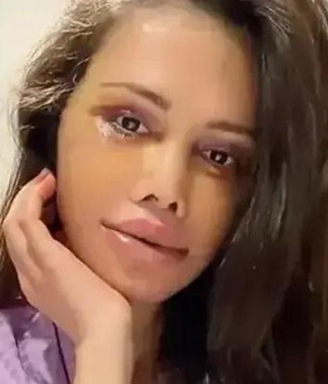 Yüz nakli olan Survivor Didem Ceran, bir kez daha bıçak altına yattı Gözyaşlarını tutamadı