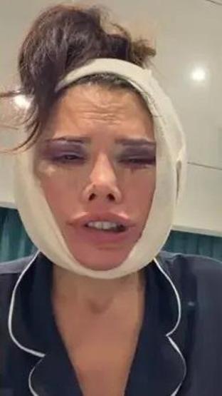 Yüz nakli olan Survivor Didem Ceran, bir kez daha bıçak altına yattı Gözyaşlarını tutamadı