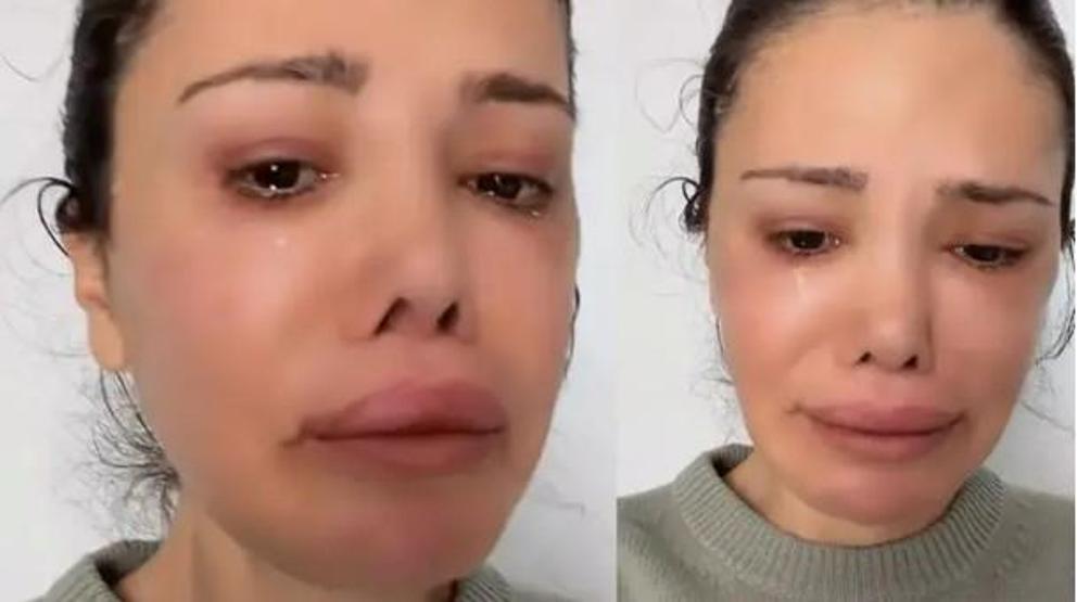 İkinci kez kapsamlı yüz operasyonu geçirmişti Didem Cerandan duygusal paylaşım: En iyi niyetli olduğum yerlerden cezalandırıldım
