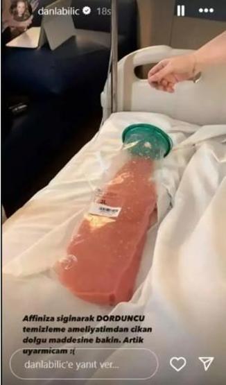 Danla Bilicin yaşadıkları yeniden gündemde Kalça dolgusu uzmanları da alarma geçirdi: Vücutta saatli bomba gibi dolaşıyor