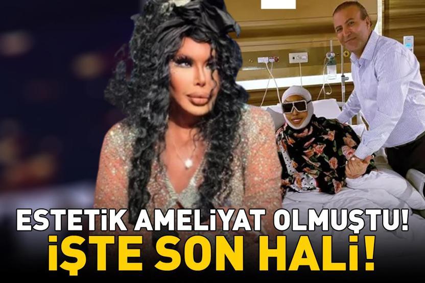 Estetik ameliyat olmuştu İşte 74 yaşındaki ünlü sanatçı Bülent Ersoyun son hali...