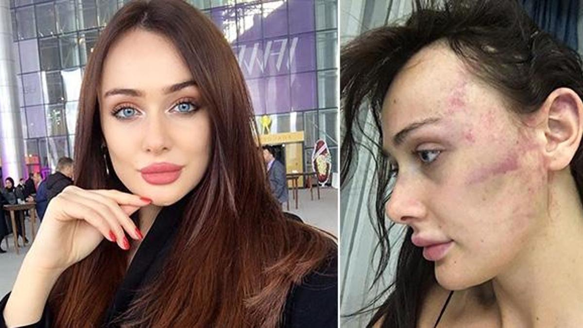 Sırp model İstanbul'da dehşeti yaşadı - Günün Haberleri CNN Türk