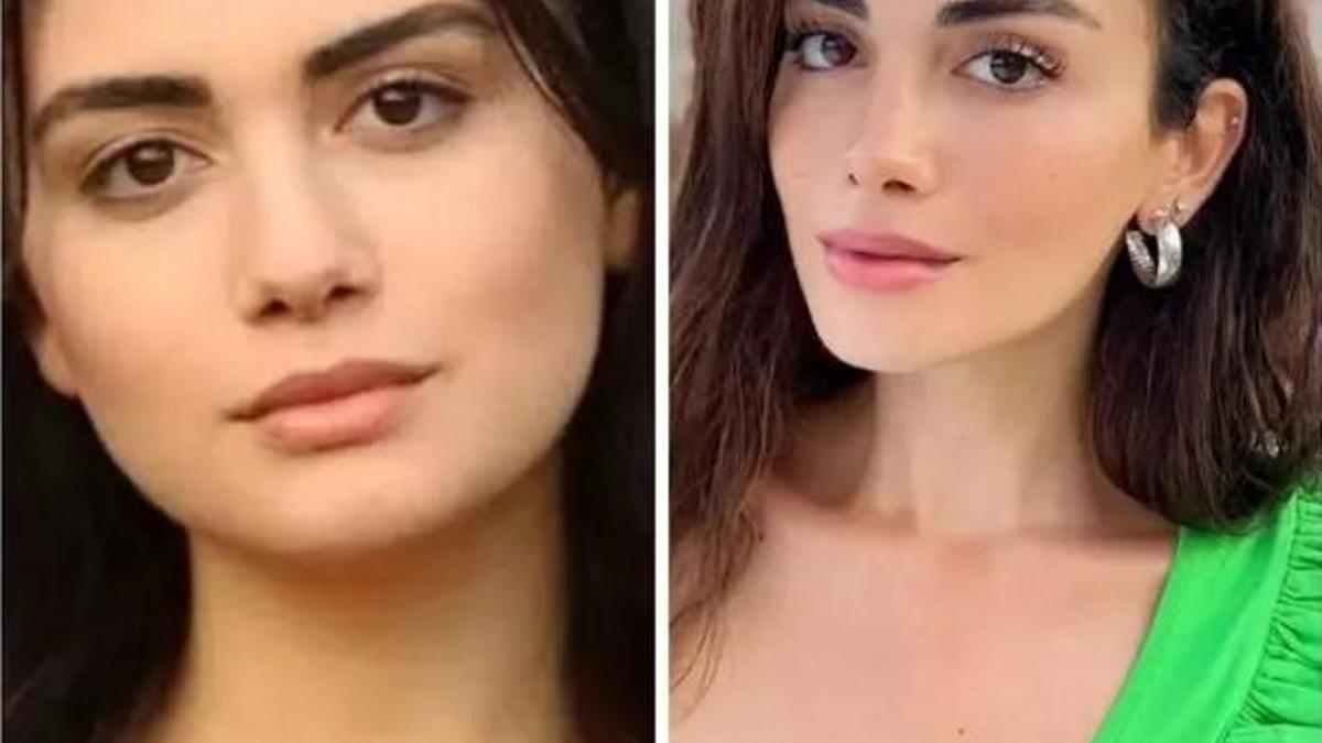 Özge Yağızın estetiksiz hali sosyal medyada gündem oldu! - Magazin  Haberleri