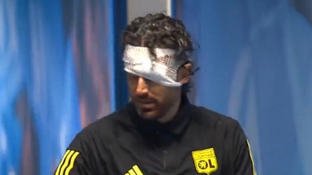 Marsilya – Lyon maçı ertelendi! Fabio Grosso yaralandı