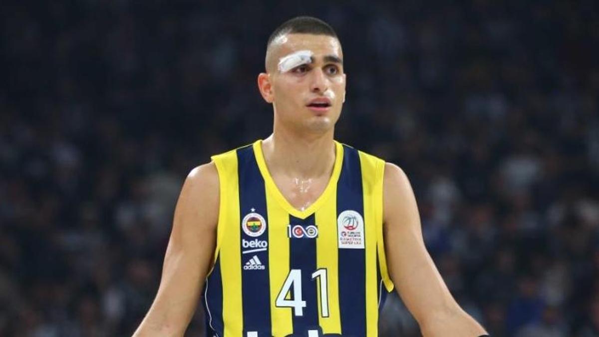 Yam Madar kısmi görme kaybı yaşadı