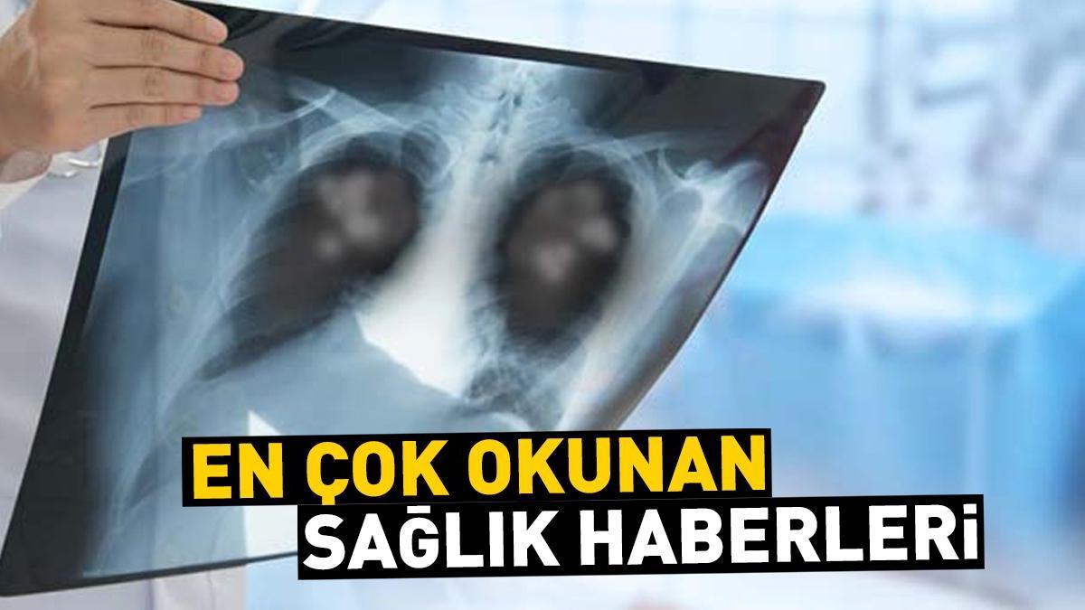 6 Ağustos 2024 günün öne çıkan sağlık haberleri...