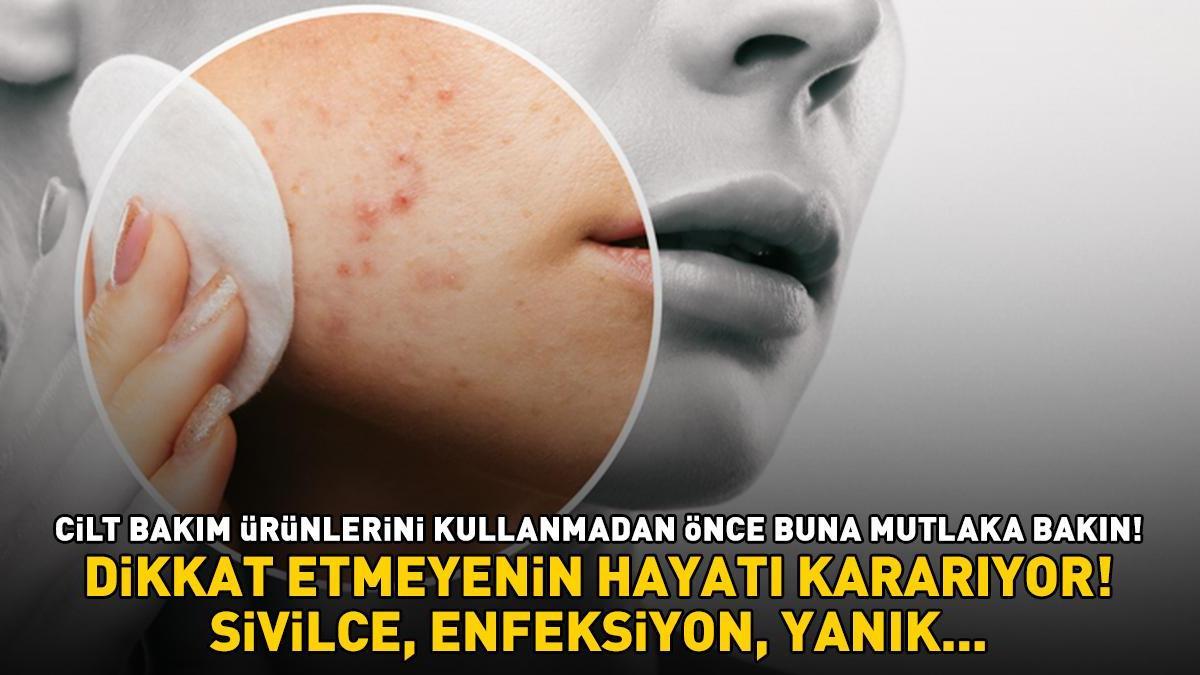 SİVİLCE, ENFEKSİYON, YANIK! Cilt bakım ürünlerini kullanmadan önce mutlaka bakın! Dikkat etmeyenin hayatı kararıyor