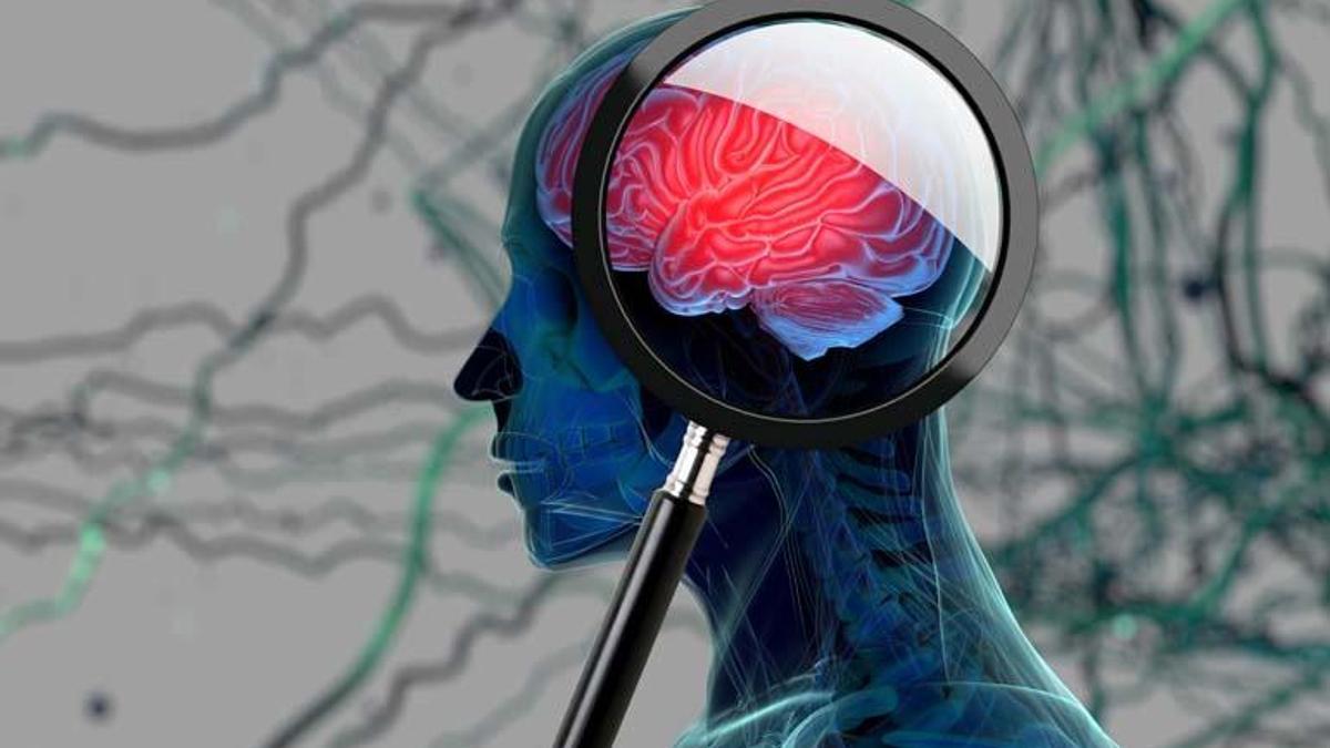 Araştırma: Alzheimer riski en düşük meslek belli oldu!