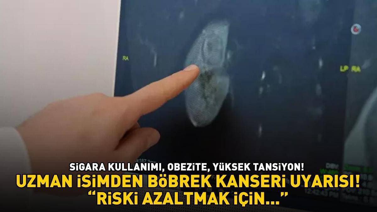 SESSİZ KATİL! Sigara kullanımı, obezite, yüksek tansiyon! Uzman isimden böbrek kanseri uyarısı: ‘Riski azaltmak için...’