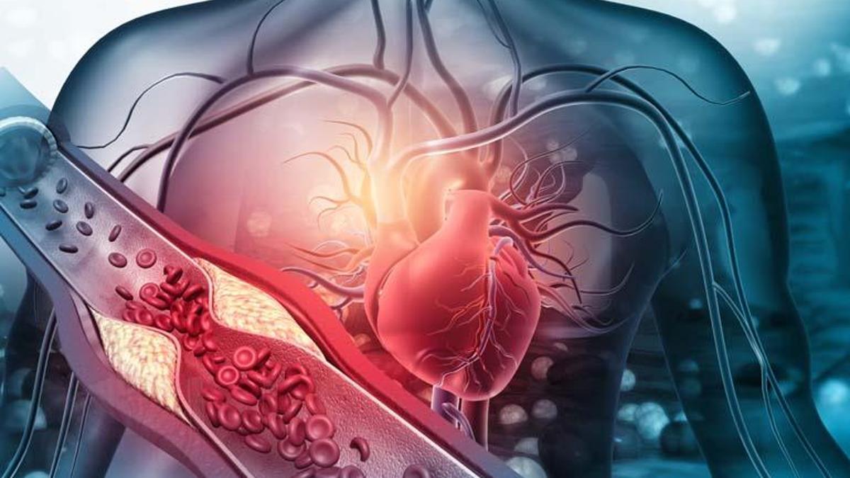 Yeni Salgın Çığ Gibi Büyüyor: ANJİYO BAĞIMLILIĞI! Kalp Damar Uzmanlarından Hayati Uyarı: Kalp Krizi Hatta Ölüme Yol Açabilir