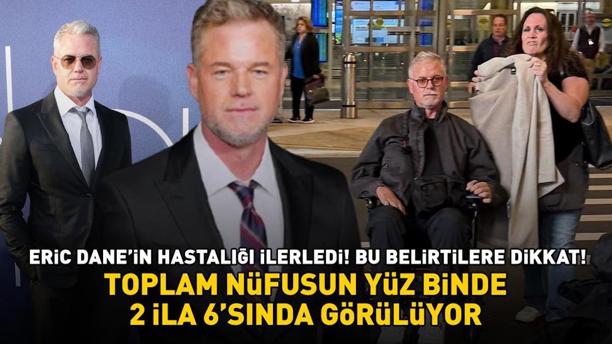Euphoria'nın yıldızı Eric Dane'nin hastalığı ilerledi! Bu belirtilere dikkat! Toplam nüfusun 100 binde 2 ila 6'sında görülüyor
