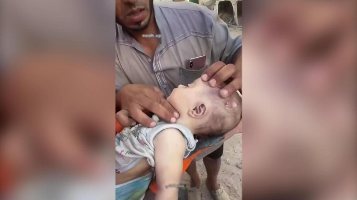 Gazze'de minik canı kurtarmak için zamanla yarıştı