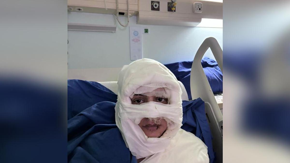 Kadıköy'de korkunç olay: Genç kadını kolonya döküp yaktı