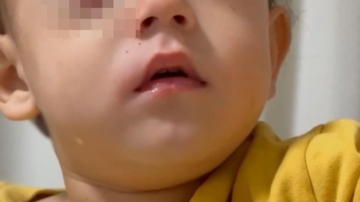 Bursa'da, 2 yaşındaki Alpaslan'ın görme yetisini kaybetmesine neden olan torpil, fırından alınmış