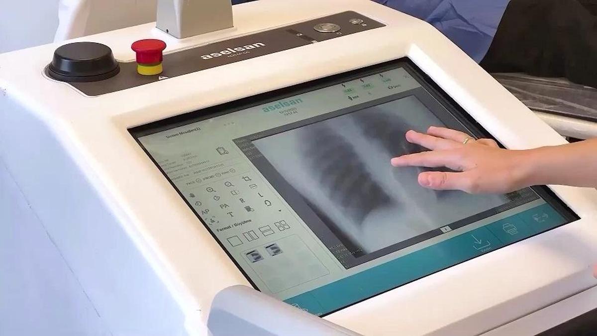 Savunmadaki tecrübe sağlığa taşındı: ASELSAN'dan yerli tıbbi görüntüleme cihazı adımı