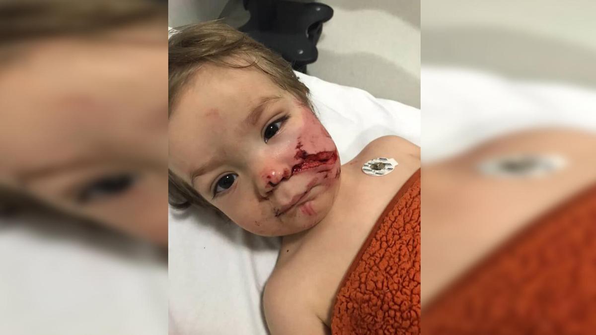 Etimesgutta pitbull vahşeti: 1,5 ve 5 yaşındaki çocuklar dehşeti yaşadı! Baba isyan etti: Çocuklarımın yüzüne bakamıyorum