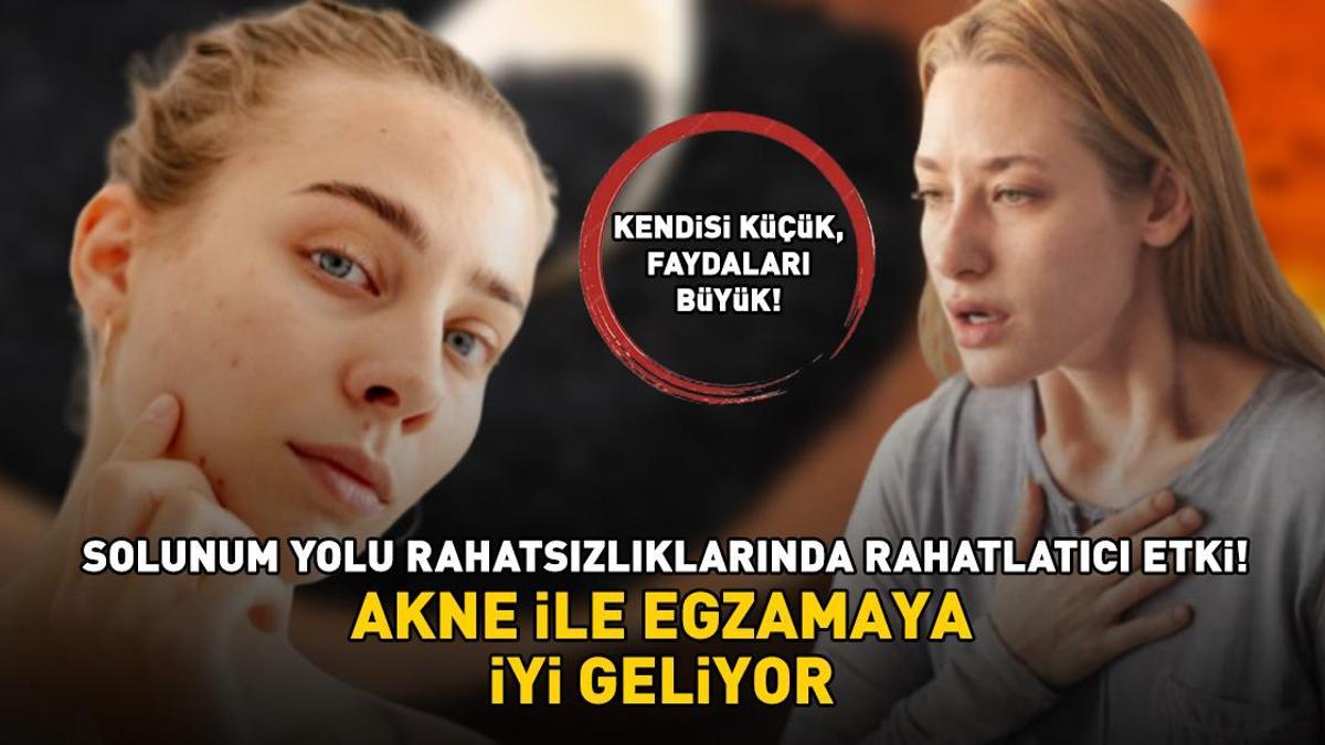AKTARLARIN EN ÇOK SATANI! Faydaları saymakla bitmiyor: Akne ile egzamaya iyi geliyor; solunum yolu rahatsızlıklarında rahatlatıcı etki gösteriyor