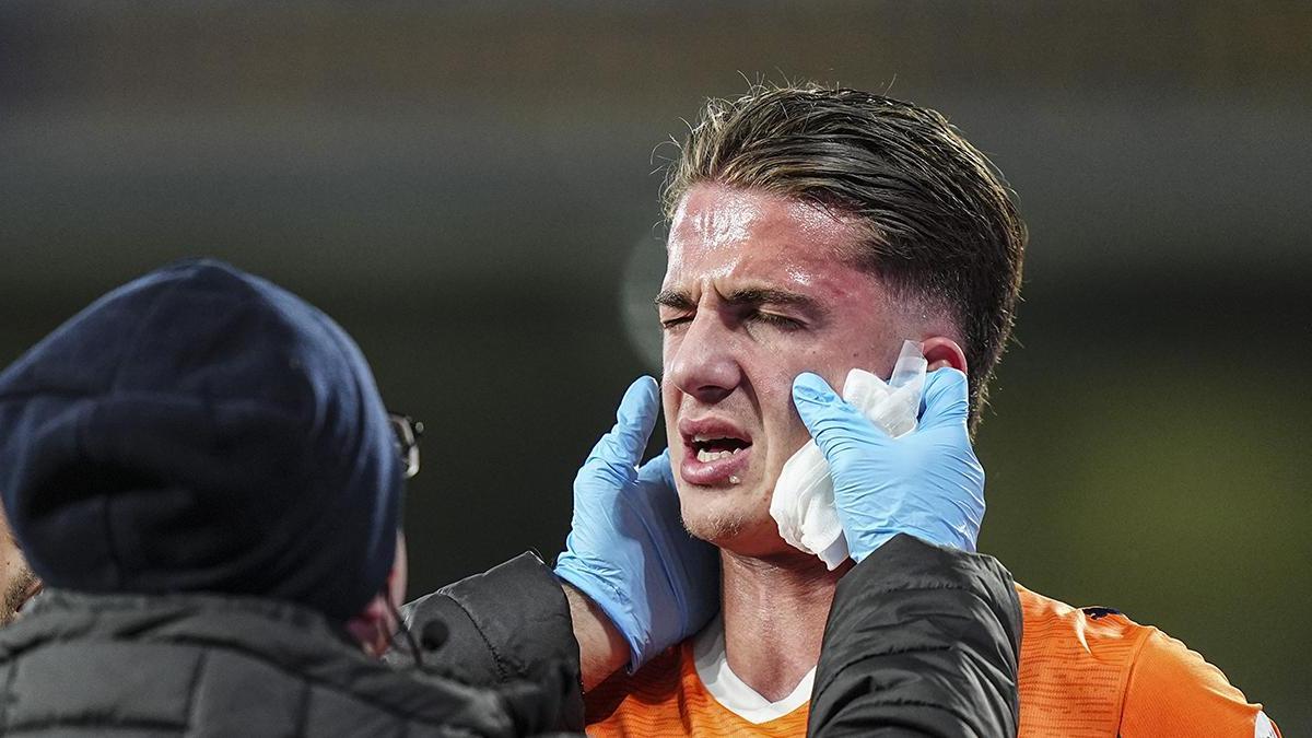 Beşiktaş maçında elmacık kemiği kırılan Bertuğ Yıldırım, ameliyat edildi