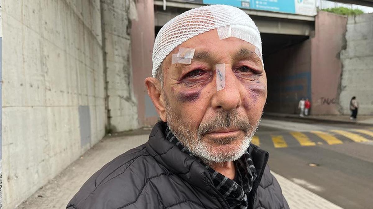 Kocaeli'de akılalmaz olay! Önce çakmak istediler, sonra hastanelik ettiler