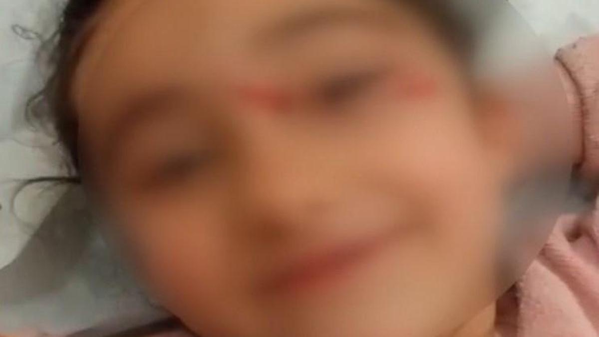 İstanbul - Eyupsultan'da okuldan eve dönen 6 yaşındaki çocuğa sokak köpekleri saldırdı