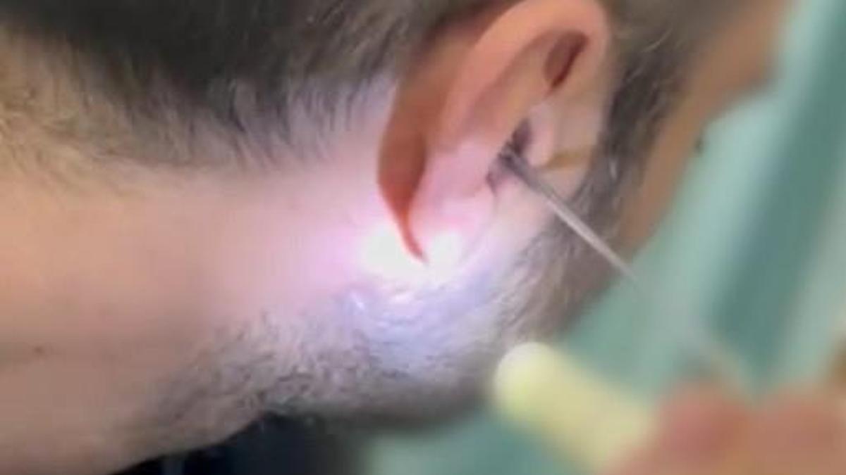 Kulağına gizlediği uyuşturucuyla yakalandı