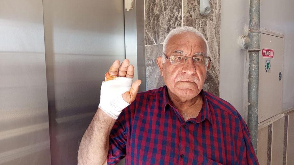 Asansörde korkunç saldırı: Komşusunun ısırdığı parmağı ampute edildi!