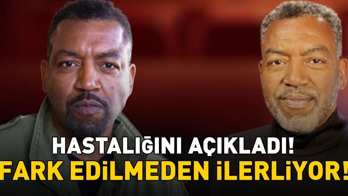 Grey’s Anatomy'nin Yıldızı Russell Andrews'ten Olay İtiraf! Bu Belirtilere Dikkat! Fark Edilmeden İlerliyor!