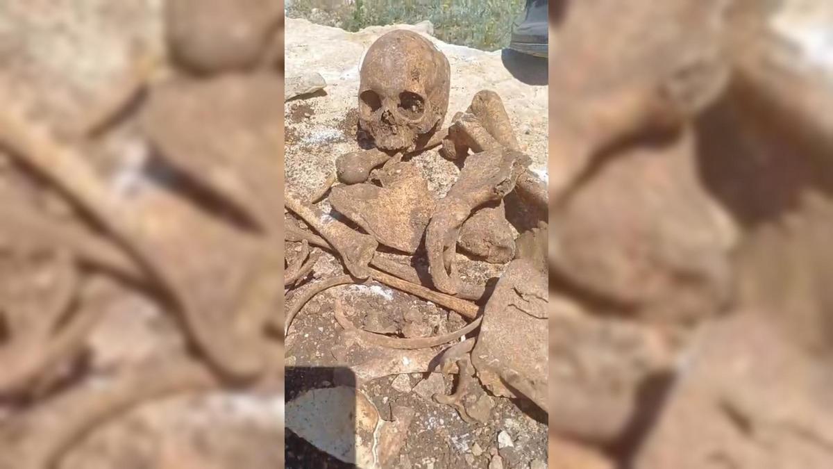 Malatya'da bir inşaat şantiyesinde kazı çalışmaları sırasında bulunan insan kemikleri ve kafatasları.