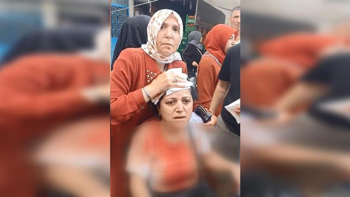 Pazarda "armut seçme" kavgası: Pazarcının kalasla yaraladığı kadının kafasına 10 dikiş atıldı