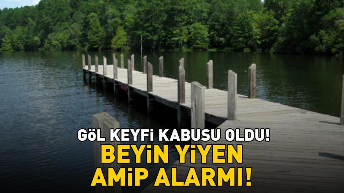 Göl keyfi kabusu oldu! 'Beyin yiyen amip' alarmı! haber görseli