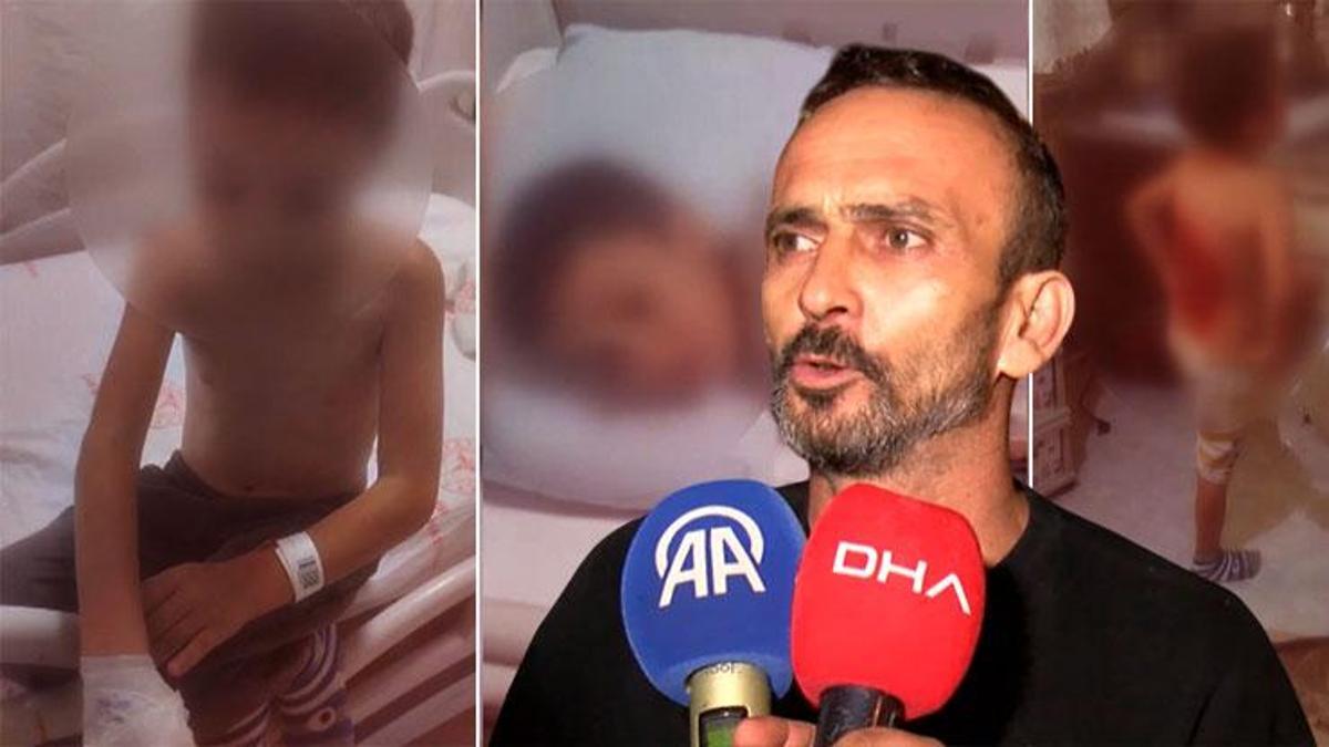 İstanbul'da akran dehşeti! Sırtına kolonya döküp yaktılar