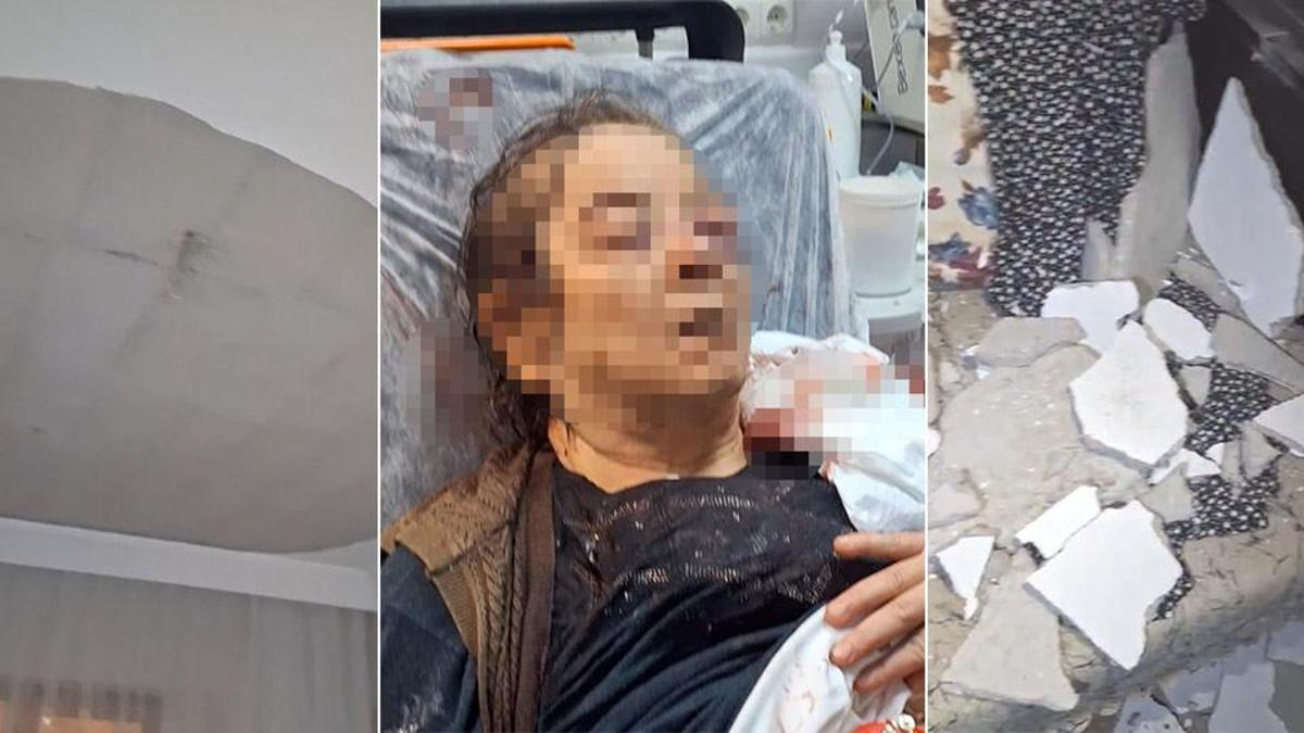 Evinde otururken üzerine tavan çöktü! 75 yaşındaki kadın görme kaybı yaşıyor