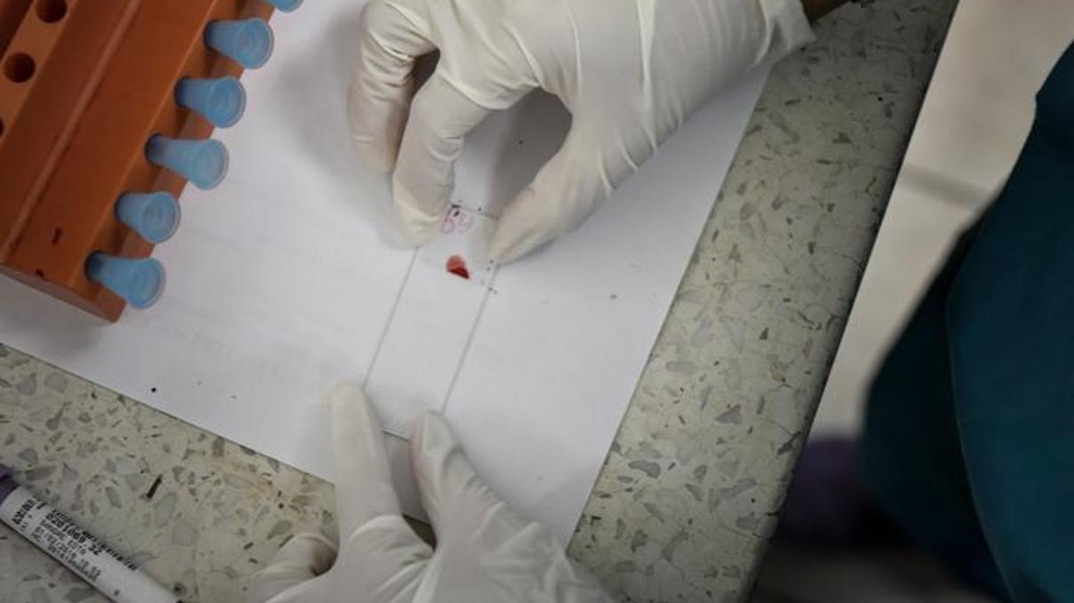 Zika virüsü kan nakliyle de bulaşabiliyor Zika virüsü kan nakliyle de bulaşabiliyor