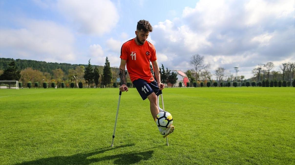 Ampute futbolda Dünya Kupası heyecanı başlıyor Ampute futbolda Dünya Kupası heyecanı başlıyor