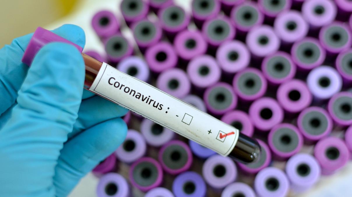 Corona virüsünde son durum ne Koronavirüste ölü sayısı artıyor Corona virüsünde son durum ne Koronavirüste ölü sayısı artıyor