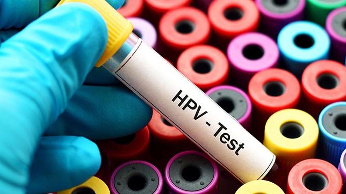HPV virüsü nedir, nasıl bulaşır Tedavi yöntemleri nelerdir HPV virüsü nedir, nasıl bulaşır Tedavi yöntemleri nelerdir