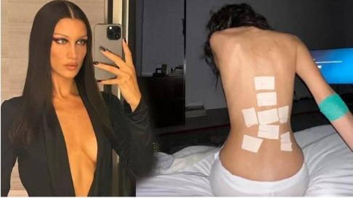 Bella Hadid hastanelik oldu Bella Hadid hastanelik oldu