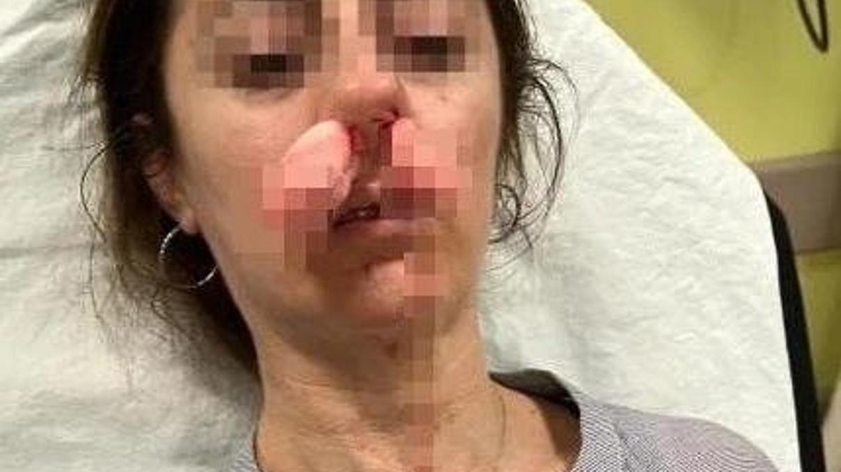 Eşinin sevgilisi sanıp darp etti İddianamede şok detay: Otomobil kapısı silah sayıldı