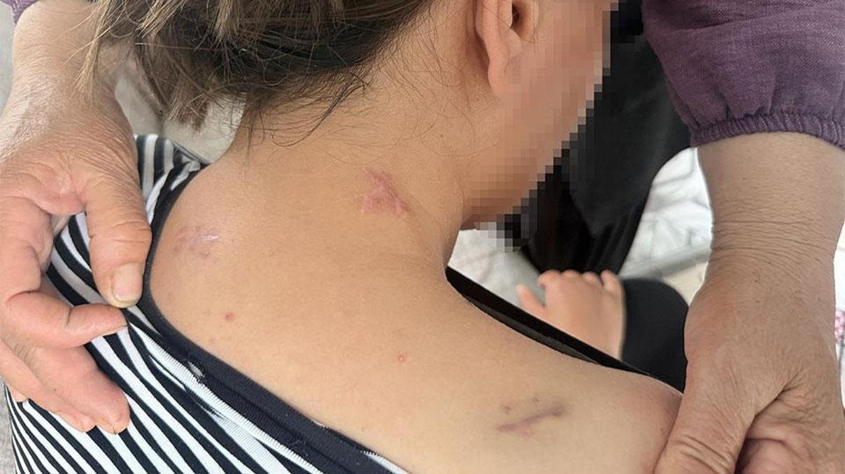 17 bıçak darbesi aldı, ölü numarasıyla kurtuldu Kocasının en ağır cezayı almasını istiyor... 17 bıçak darbesi aldı, ölü numarasıyla kurtuldu Kocasının en ağır cezayı almasını istiyor...
