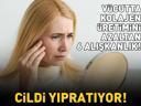 30’lu Yaşlardan Sonra Cilt Neden Değişiyor Kolajen Kaybını Hızlandıran 6 Alışkanlık