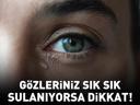 Gözleriniz Sık Sık Sulanıyorsa Dikkat Basit Bir Hassasiyet Sanılıyor Ama…