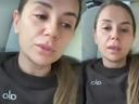 Merdivenden Düşmüştü Merve Özbey Sağlık Durumunu Açıkladı