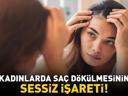 Kadınlarda Saç Dökülmesinin Sessiz İşareti Saç Ayrım Çizgisindeki Değişimi Hafife Almayın