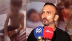 İstanbulda akran dehşeti Sırtına kolonya döküp yaktılar