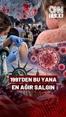 ABD’de 35 Yılın En Ağır Kızamık Salgını! New York’ta Acil Durum