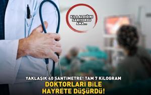 YAKLAŞIK 40 SANTİMETRE, TAM 7 KİLOGRAM! Doktorları bile hayrete düşürdü! Kilo aldığını sanıyordu, gerçek çok farklı çıktı!