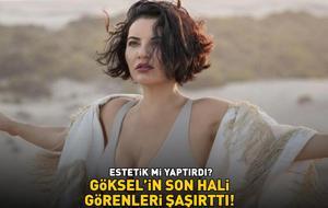 ESTETİK Mİ YAPTIRDI? Göksel'in son hali sosyal medyayı salladı!