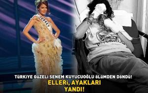 Türkiye Güzeli Senem Kuyucuoğlu ölümden döndü! ELLERİ, AYAKLARI YANDI!