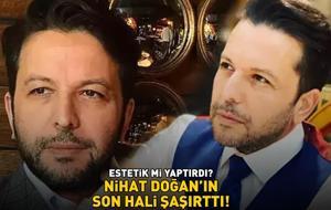 ESTETİK Mİ YAPTIRDI? Nihat Doğan'ın son hali şoke etti